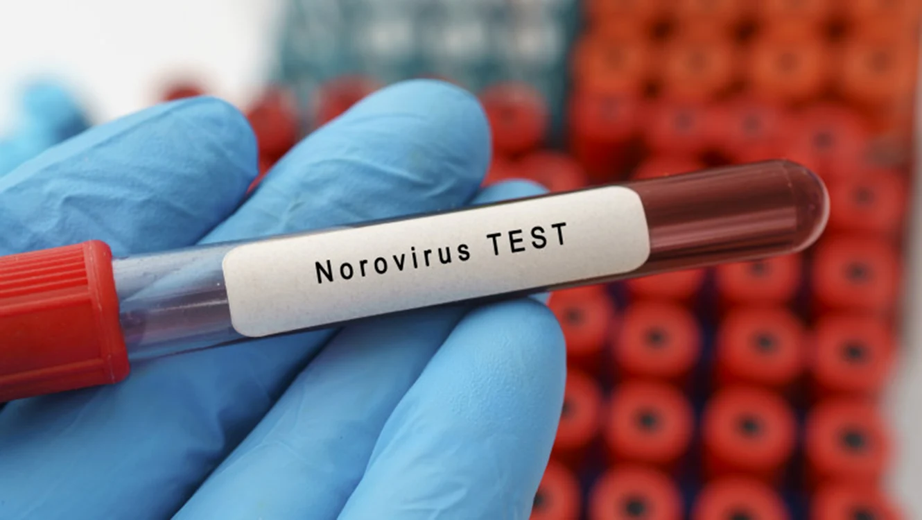 Autoritățile încearcă să gestioneze răspândirea rapidă a Norovirusului